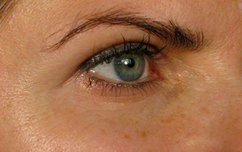 Eyes before