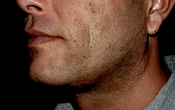Face before